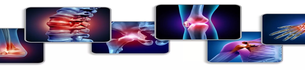 علاج العظام